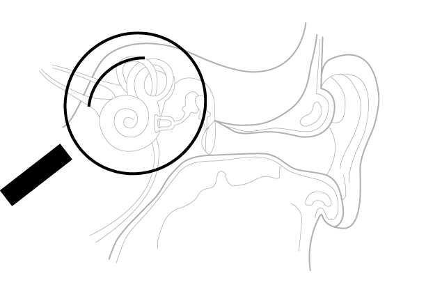 WARP-prosessering inne i øret